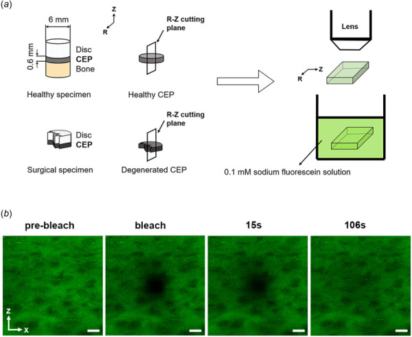 Schematic of specimen preparation and testing protocols. (a) Schematic of specimen preparation. (b) Time-series of FRAP measurements including prebleaching, bleaching, and 106 s postbleaching events. Scale bars represent a length of 50 μm. Note: CEP represents cartilage endplate. Radial (r) and axial (z) directions are parallel and perpendicular to vertebral body, respectively.