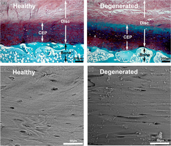 Histological images of disk and bone interfaces ((a) and (b)) and SEM images of CEP regions ((c) and (d)) from healthy and degenerated groups