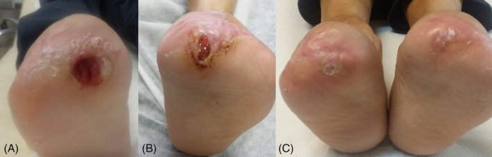 FIGURE 3
