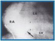 Figure 51