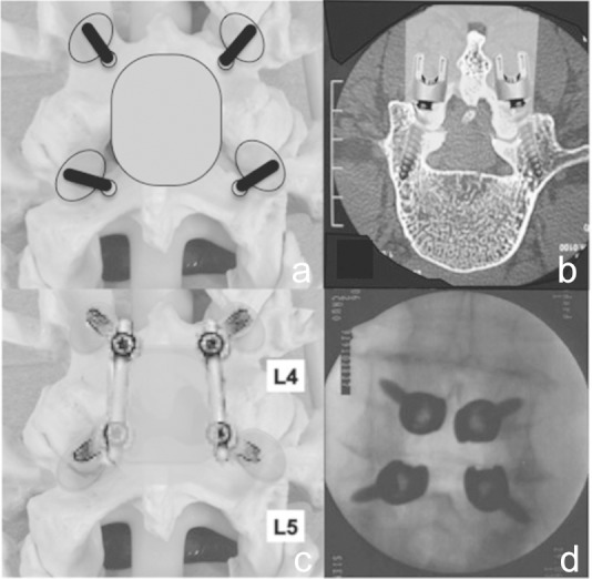 Fig. 4