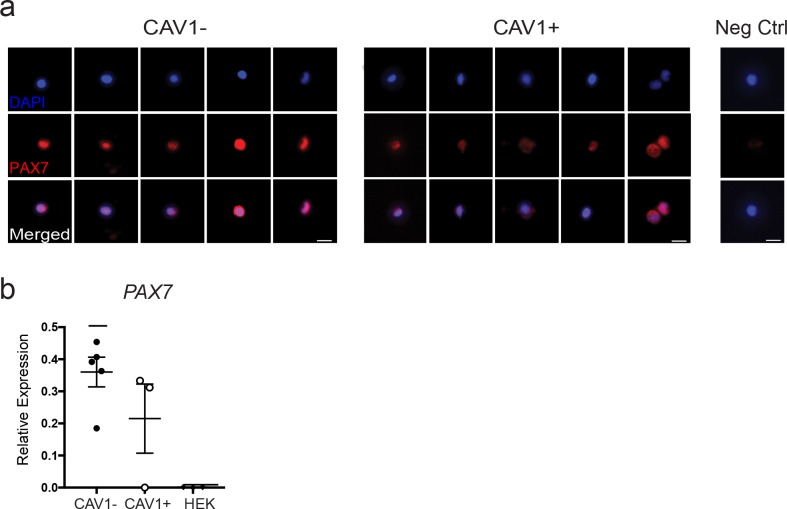 Figure 5—figure supplement 1.