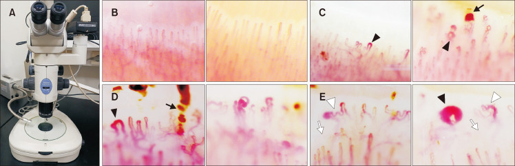 Fig. 3