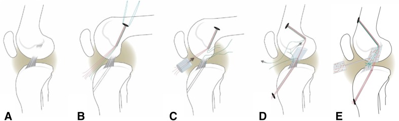 Fig. 1A–E