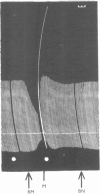 Fig. 13