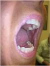 Fig 2
