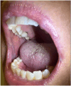 Fig 3