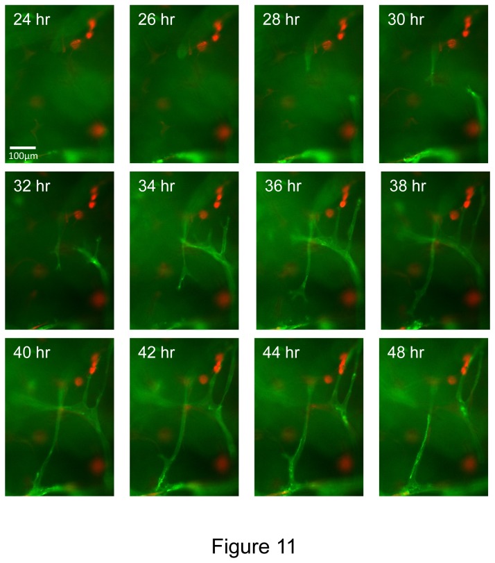 Figure 11