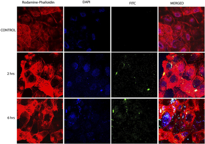 FIGURE 14