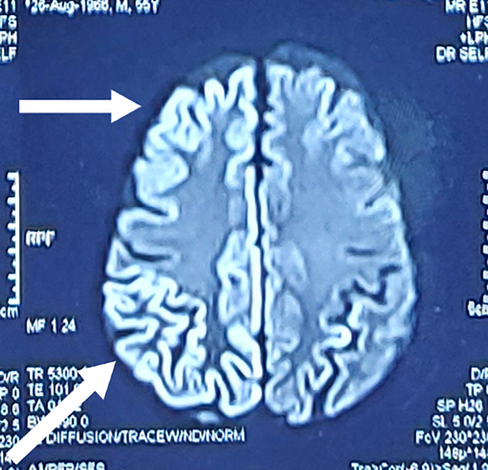 Fig. 2.