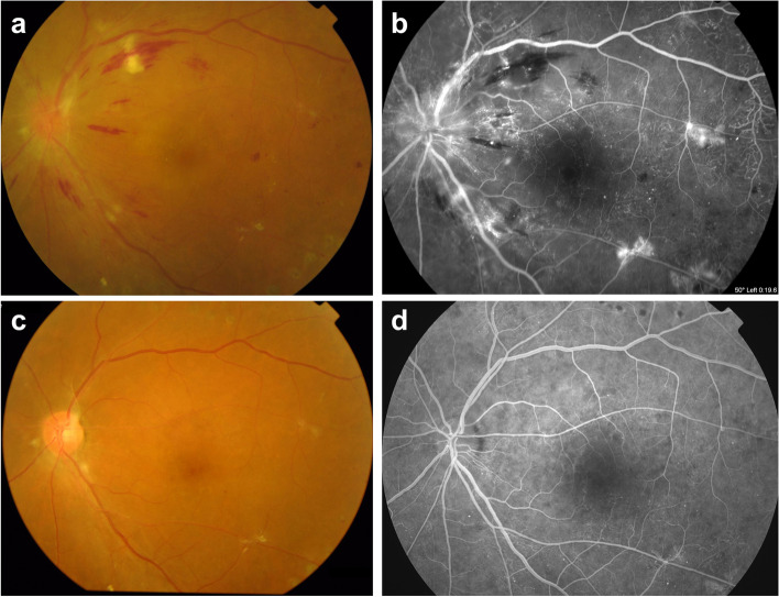 Fig. 2