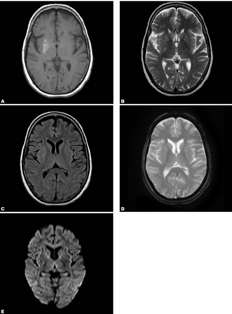 Fig. 1