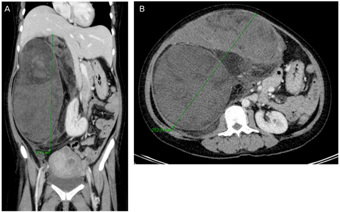 Fig. 1