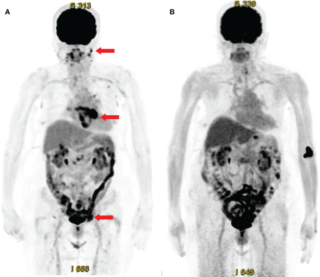 Figure 3