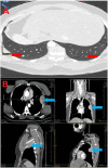 Fig. 4