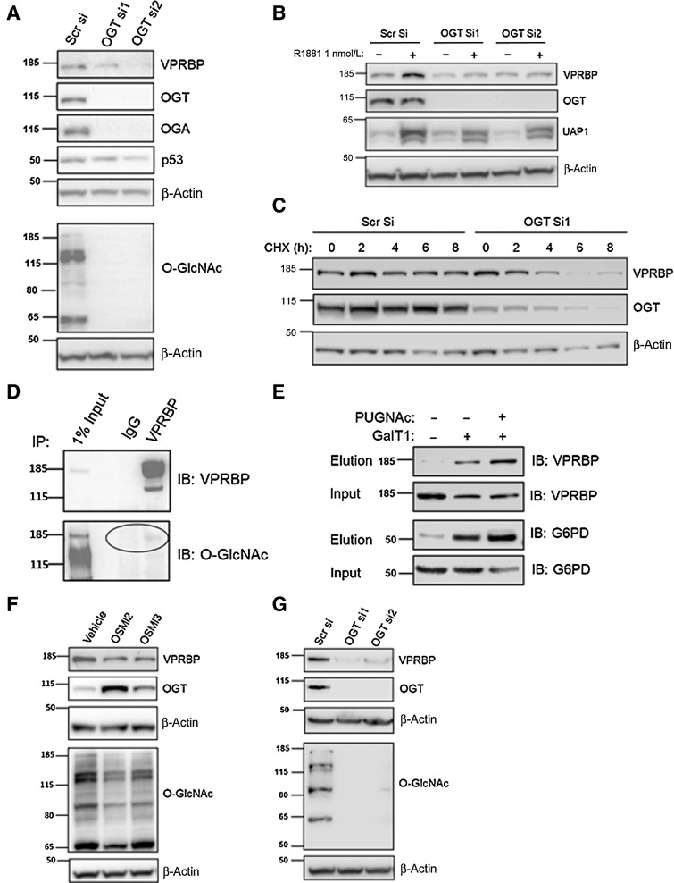 Figure 2. OGT is required for VPRBP stability. A, LNCaP cells were transiently transfected with OGT siRNAs and cells were harvested 5 days posttransfection to examine protein expression under basal conditions by immunoblot analysis. B, For detection of protein expression under androgen-stimulated conditions, LNCaP cells were transfected with OGT siRNAs or scrambled siRNA (scr si) followed by androgen deprivation for 72 hours prior to 1 nmol/L R1881 stimulation for 24 hours. C, Cycloheximide (50 µg/mL) chase experiment was conducted from 0 to 8 hours to assess the impact of OGT knockdown (72 hours) on the degradation of VPRBP. D, The O-GlcNAcylation of IP VPRBP from LNCaP cells was detected by immunoblotting (IB) with RL2 antibody. E, O-GlcNAcylated VPRBP was detected from LNCaP cytoplasmic extract. Lysates prior to pull down (input) and the captured proteins (elution) were immunoblotted (IB) with an antibody toward VPRBP as well as positive control G6PD. Control experiments in the absence of GalT demonstrated selective labeling of the O-GlcNAcylation on VPRBP and G6PD. F, The effect of OGT inhibitors 40 µmol/L OSMI2 and 10 µmol/L OSMI3 on VPRBP protein levels following 24-hour treatment was detected by immunoblot analysis. G, The effect of OGT knockdown on VPRBP protein expression in 22Rv1 cells by immunoblot analysis.