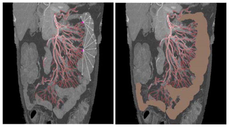 Fig. 11