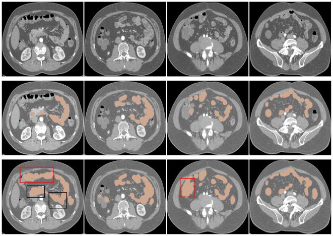 Fig. 15