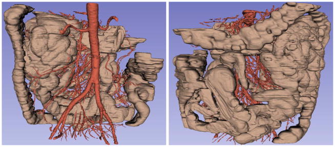 Fig. 16