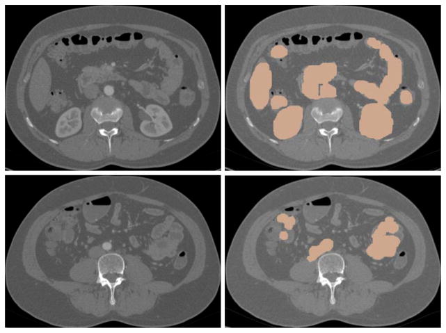 Fig. 17