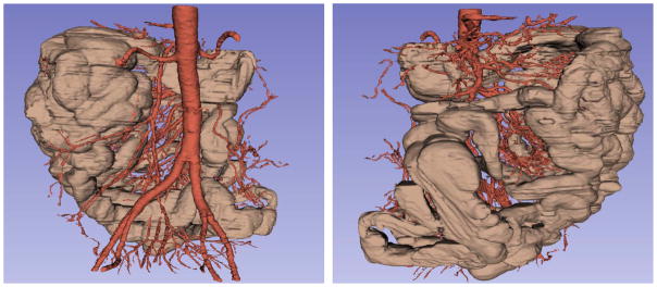 Fig. 18