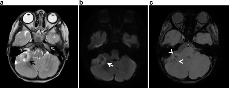 Fig 5