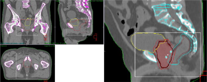 Fig. 1