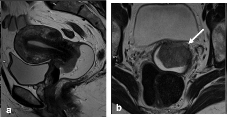 Fig. 13