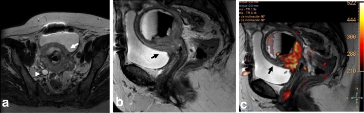 Fig. 18