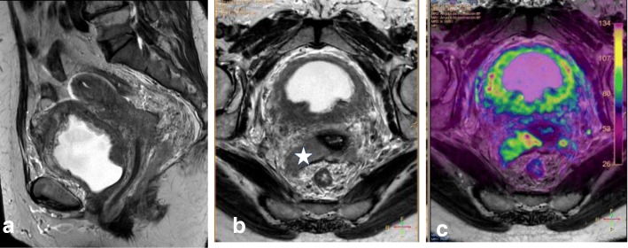 Fig. 22