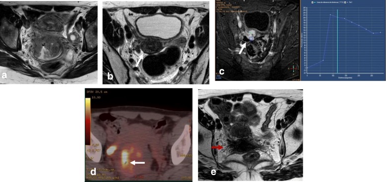 Fig. 19