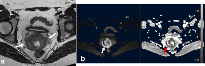 Fig. 15