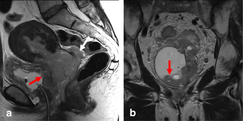 Fig. 17