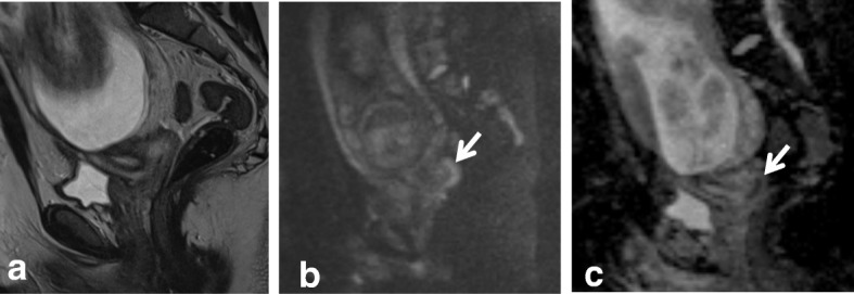 Fig. 12