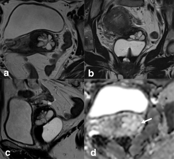 Fig. 20