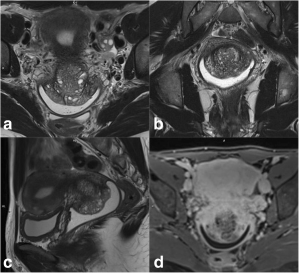 Fig. 21