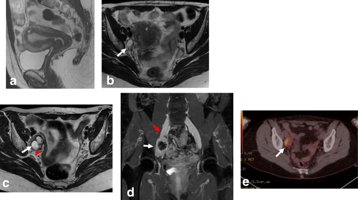 Fig. 25