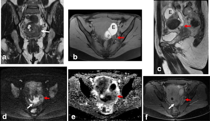 Fig. 16