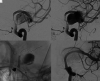 FIG 3.