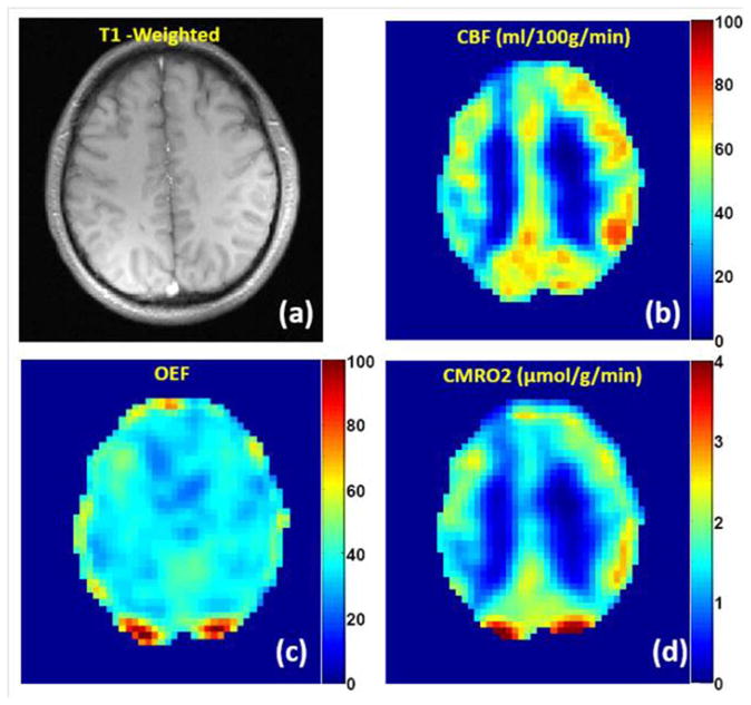 Figure 15