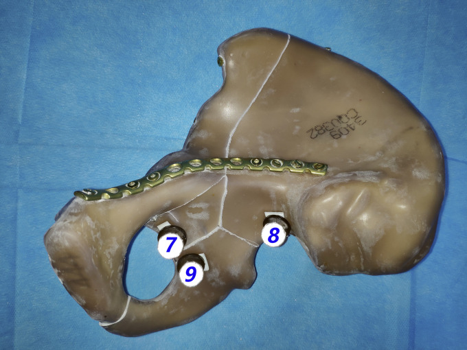 Fig. 2-B