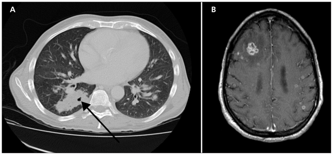 Figure 1: