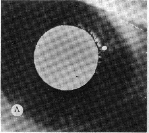 FIGURE 5 A