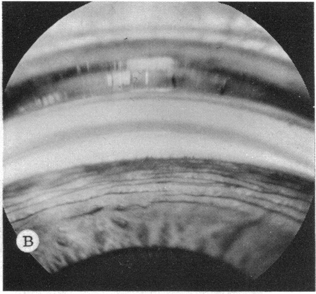 FIGURE 6 B