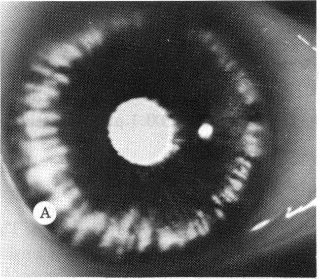 FIGURE 4 A