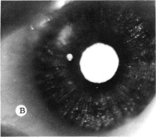 FIGURE 1 B