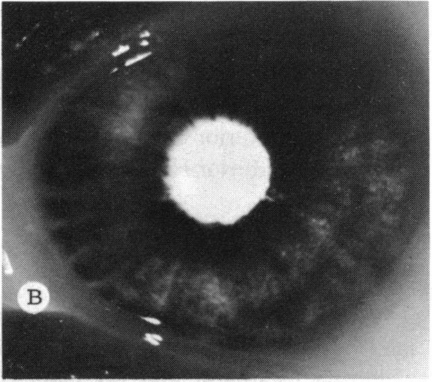 FIGURE 4 B