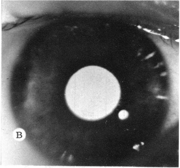 FIGURE 7 B