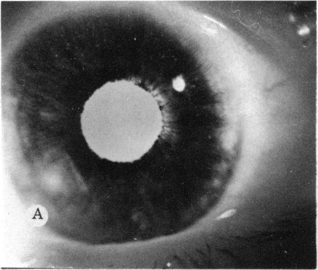 FIGURE 3 A