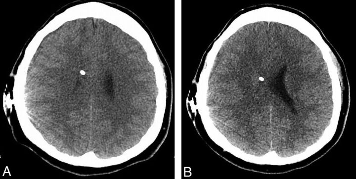 Fig 5.